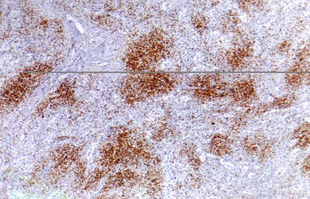 Fig. 9: CD45RO - <div style=